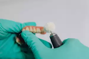 Zubní Implantáty Cena